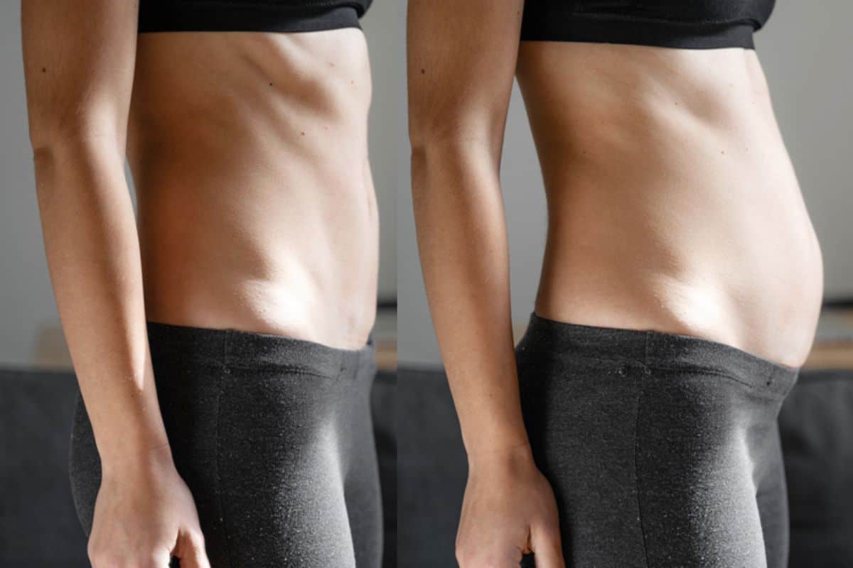 How long does diastasis recti take to improve Maidstone?