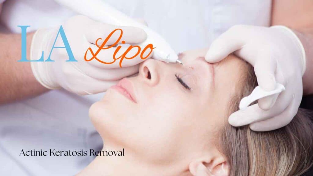 actinic keratosis removal  Maidstone