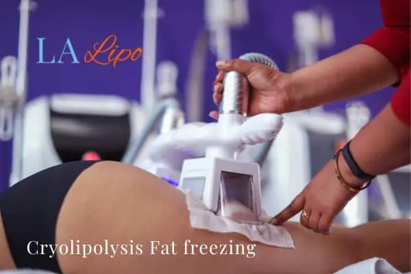 women getting fat freezing  Maidstone