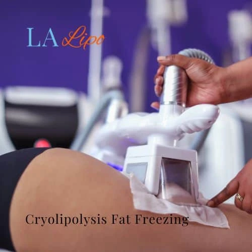 fat freezing - Cryolipolysis  Maidstone