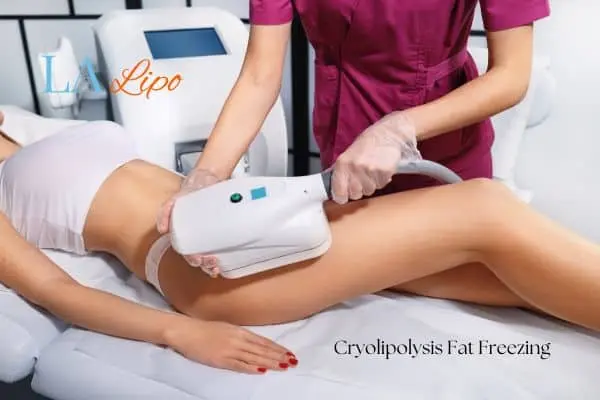 Woman receiving coolsculpting Maidstone treatment on her thighs