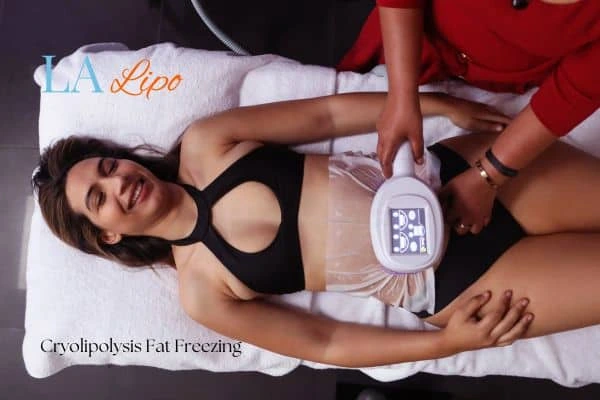 woman getting cryolipolysis  Maidstone
