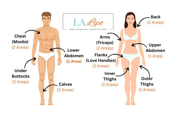 LA LIPO Cryolipolysis Areas  Maidstone