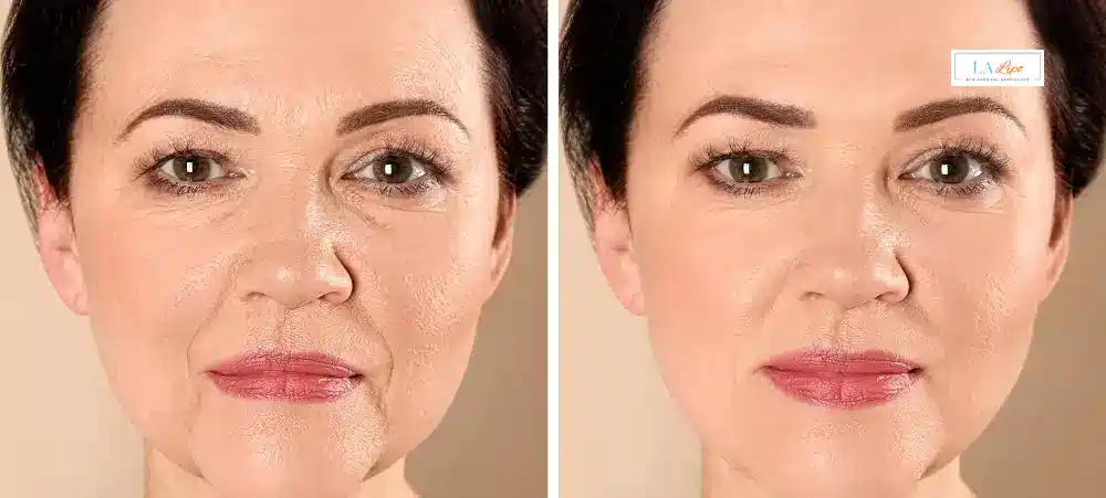 How Long Does It Take to See Results and How Long Do They Last Maidstone?